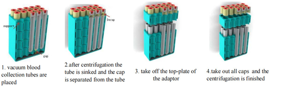 Centrifuge Decapping Otomatis CTK 80 Klinis Untuk Rumah Sakit