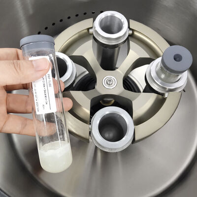 Mesin sentrifugal PRP dengan kecepatan maksimum 5000 rpm 3555xg RCF dan LCD Display untuk penggunaan laboratorium
